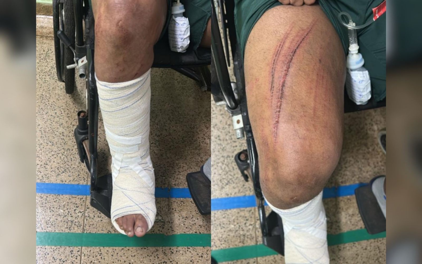 Garoto de programa pula do 2º andar para fugir de cliente após briga por causa do pagamento, diz polícia Garoto de programa pula do 2º andar para fugir de cliente após briga por causa do pagamento, diz polícia