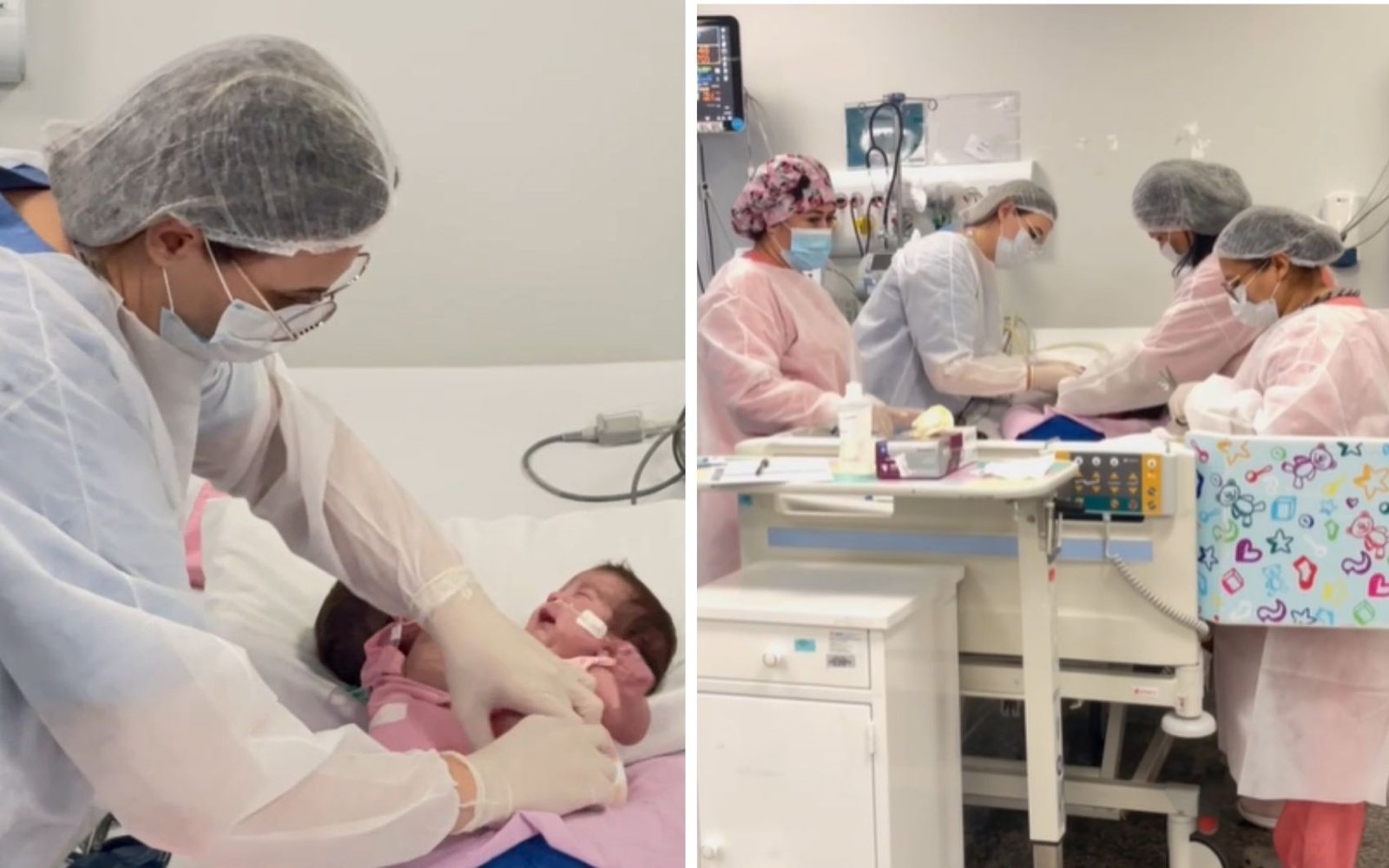 Mãe de siamesas unidas pelo tórax e abdômen mostra viagem a Goiás para cirurgia de separação: ‘Expectativa que seja um sucesso’ Mãe de siamesas unidas pelo tórax e abdômen mostra viagem a Goiás para cirurgia de separação: ‘Expectativa que seja um sucesso’