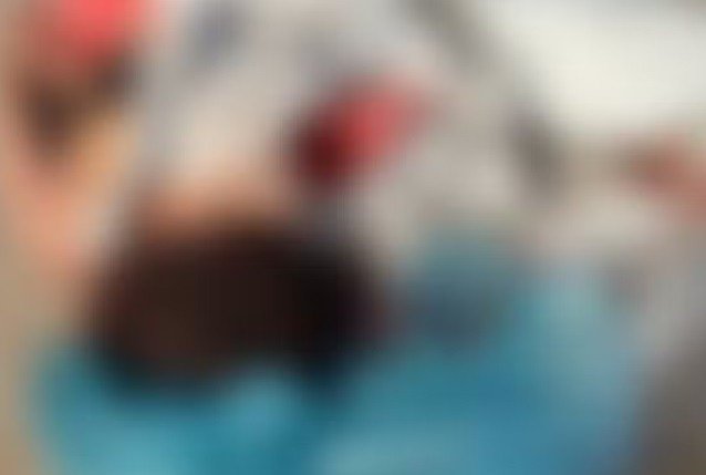 Perícia aponta que mulher trans morreu de traumatismo craniano após ser espancada em Maceió Perícia aponta que mulher trans morreu de traumatismo craniano após ser espancada em Maceió