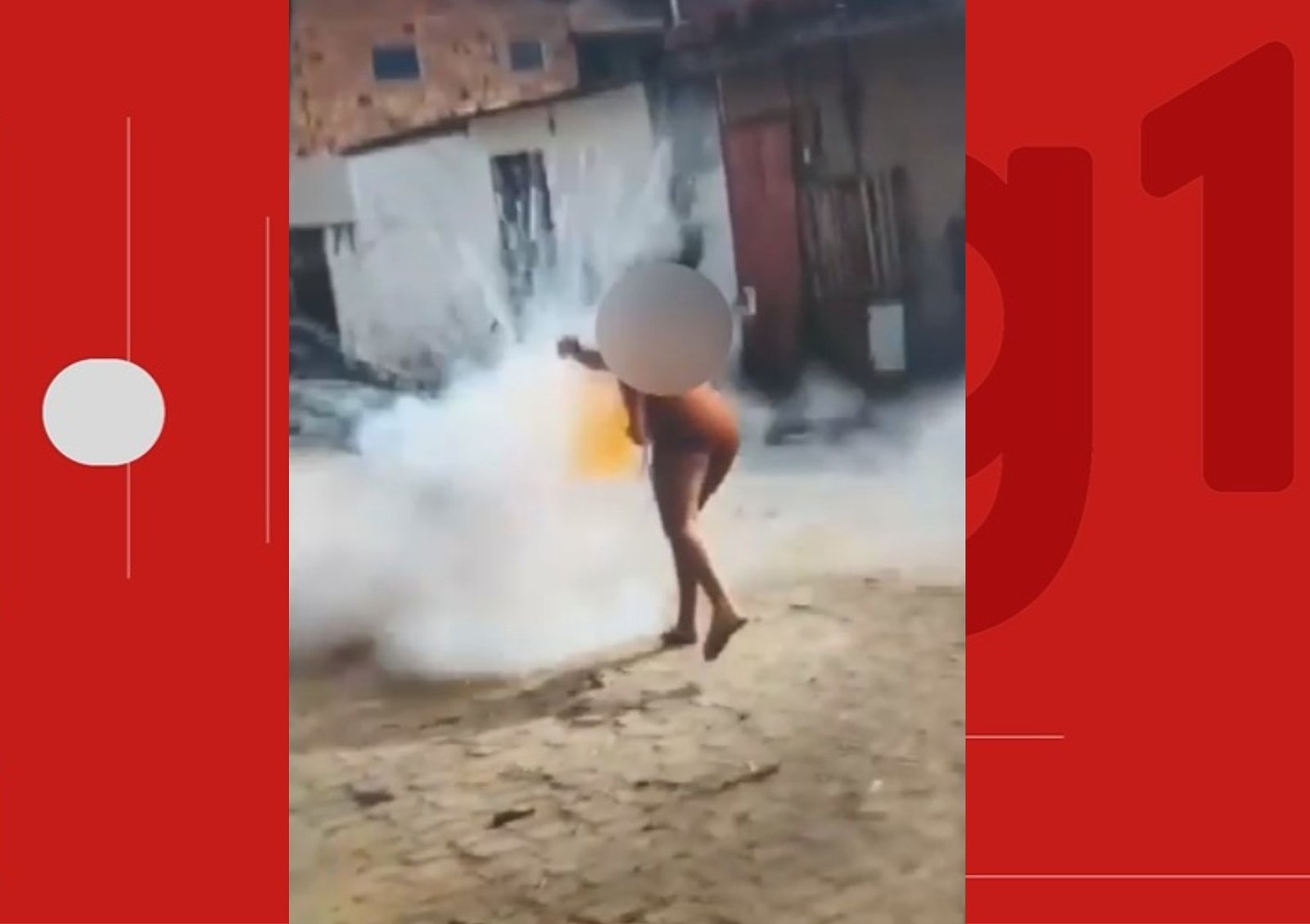 Mulher fica gravemente ferida após ter rosto atingido por espada junina em cidade da Bahia Mulher fica gravemente ferida após ter rosto atingido por espada junina em cidade da Bahia