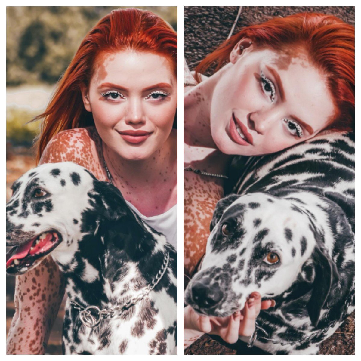 Vitiligo x tom de pele: influencer com mesma doença do Michael Jackson teve dificuldade para se identificar racialmente; entenda