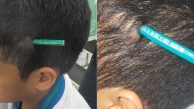 Veja o que aconteceu com o aluno que cravou lápis na cabeça de colega dentro de escola no litoral de SP