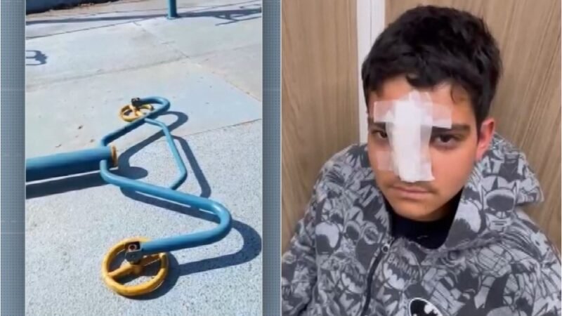 Adolescente fratura ossos do rosto após ser atingido por aparelho de academia ao ar livre em Campinas