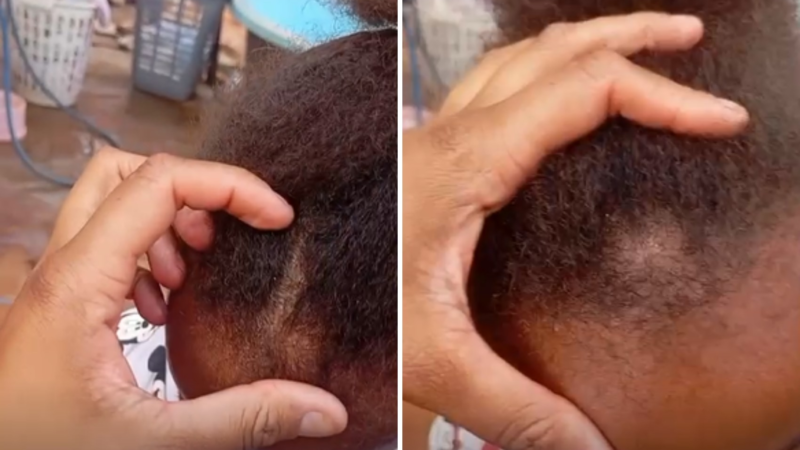 Ministério Público investiga se caso de racismo denunciado por mãe de criança em creche em Ribeirão Preto é isolado ou frequente