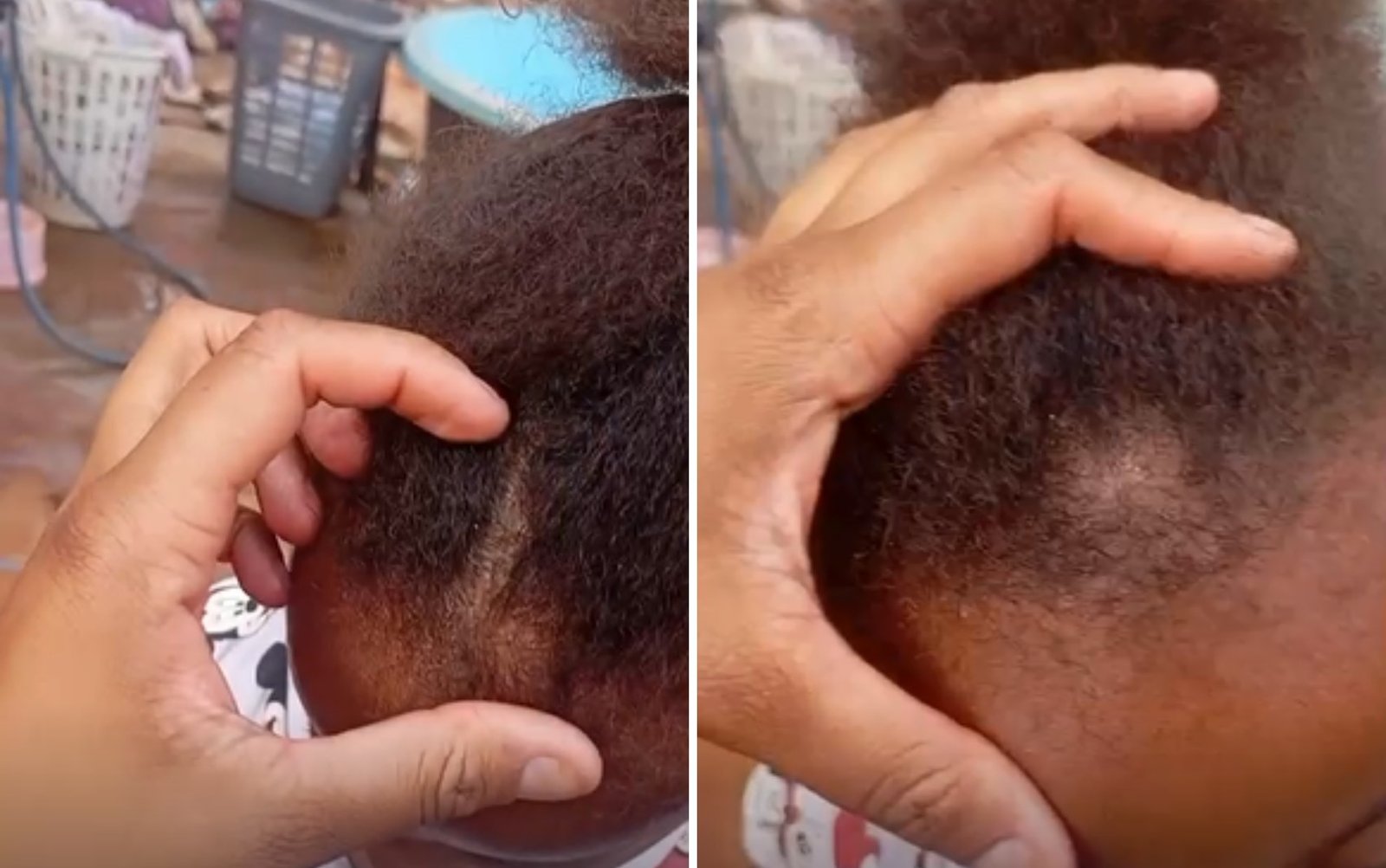 Ministério Público investiga se caso de racismo denunciado por mãe de criança em creche em Ribeirão Preto é isolado ou frequente