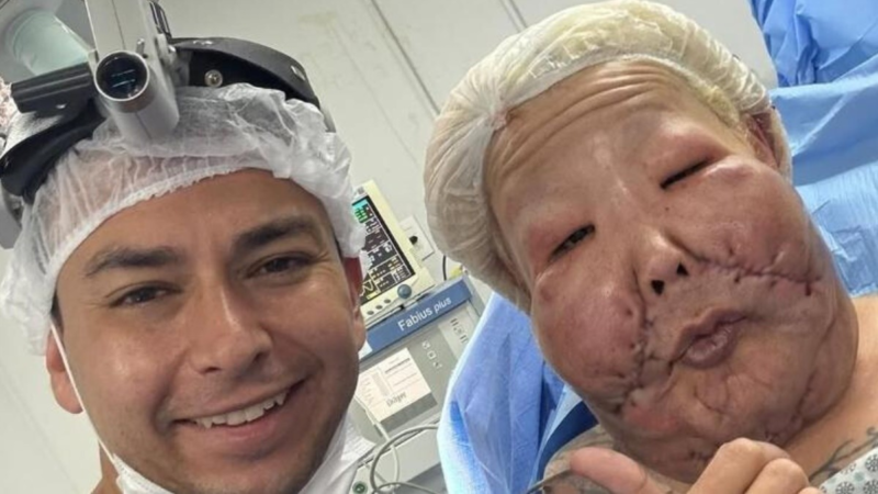 ‘Sem dor, como se nada tivesse acontecido’: Juju do Pix conta como se sentiu durante cirurgia que levou mais de 4 horas