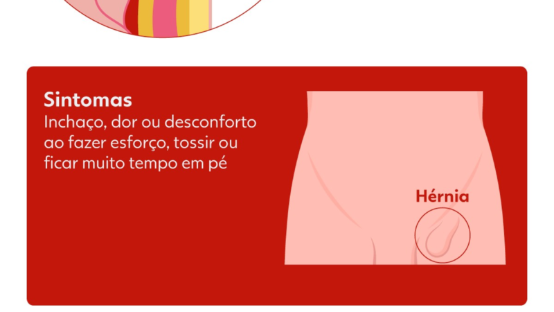 Bolsonaro passa por cirurgia para corrigir hérnia inguinal bilateral; entenda condição e procedimentos possíveis