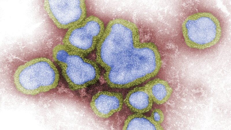 Sergipe está entre os estados com aumento na circulação da Influenza A, aponta Fiocruz