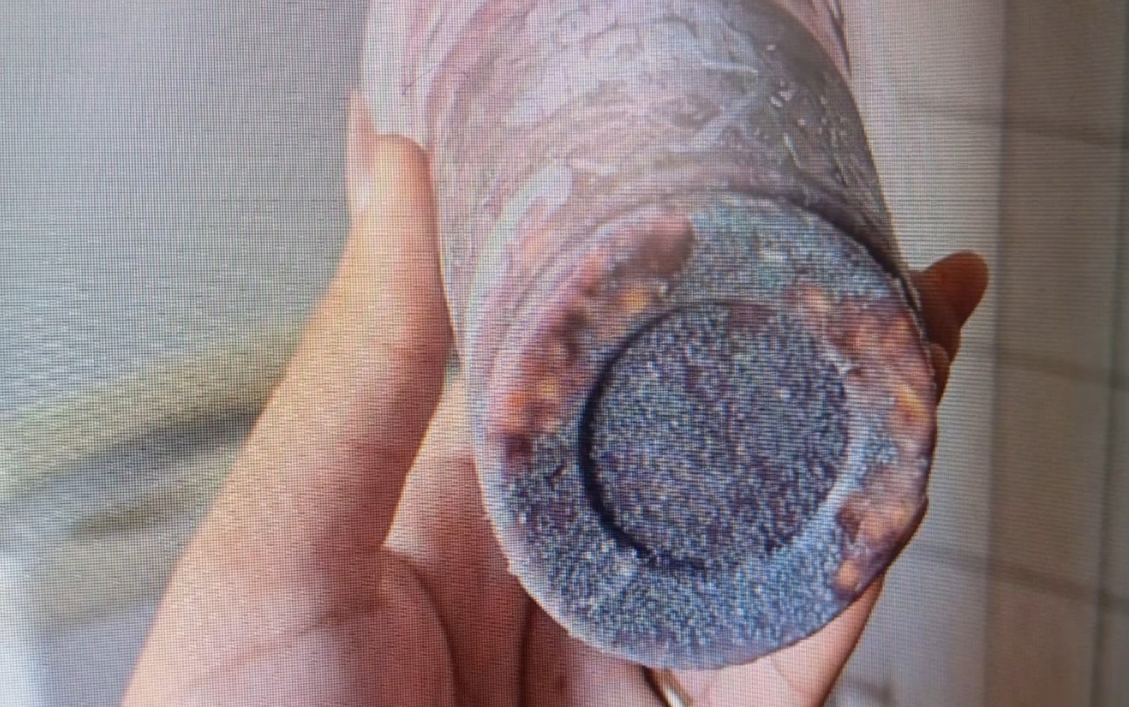 Terbufós: entenda substância usada para envenenar açaí consumido por jovem que foi parar na UTI