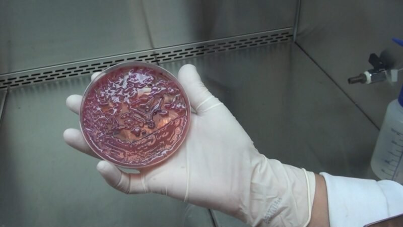 Tudo o que você precisa saber sobre superbactéria que fechou UTI do Hospital Mário Gatti, em Campinas