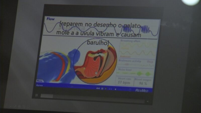 Ronco pode indicar apneia do sono, condição que aumenta risco de problemas cardiovasculares e até morte, apontam especialistas
