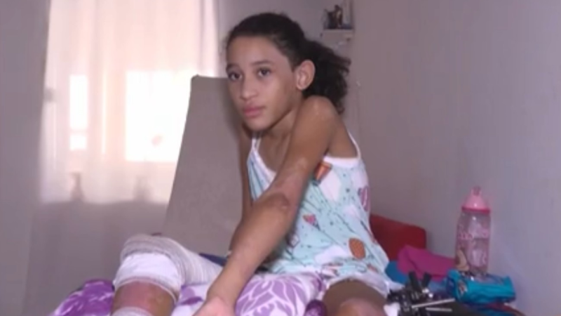 Única sobrevivente de explosão na Bahia enfrenta nova fase da recuperação após alta médica